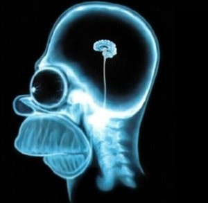 simpson-brain-SMA-blog1-300x293